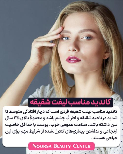 شرایط کاندید مناسب لیفت شقیقه