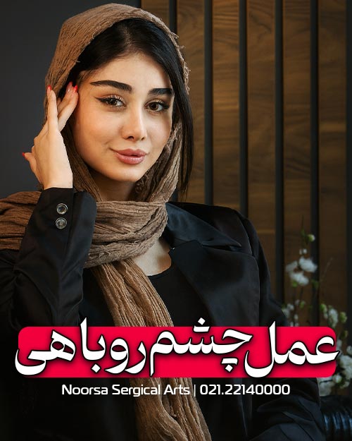عمل چشم روباهی در کلینیک زیبایی نورسا