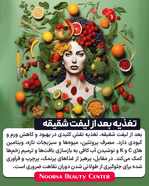 تغذیه بعد از لیفت شقیقه
