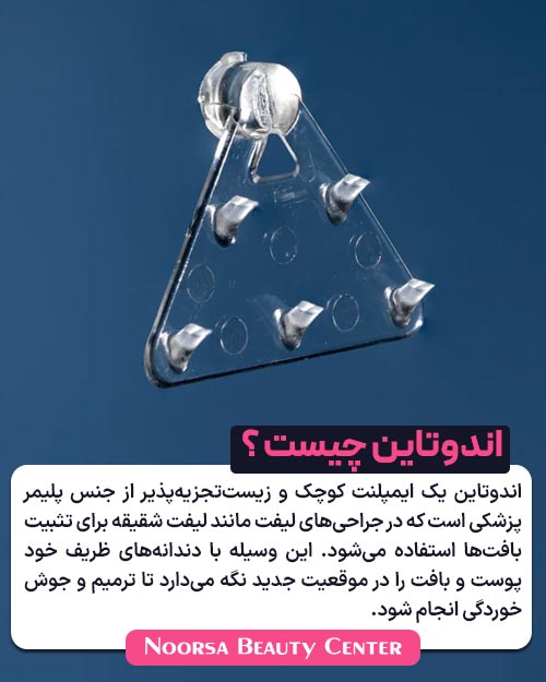 اندوتاین چیست