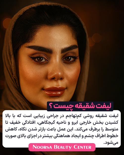 لیفت شقیقه چیست