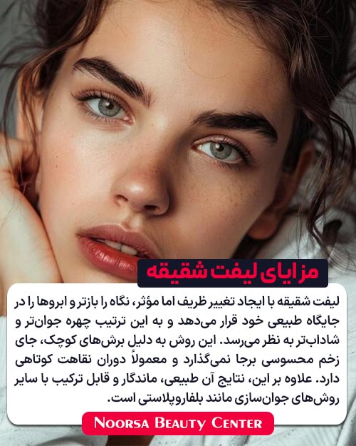 مزایای لیفت شقیقه برای جوان‌سازی چشم‌ها