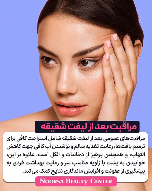 مراقبت های بعد از لیفت شقیقه