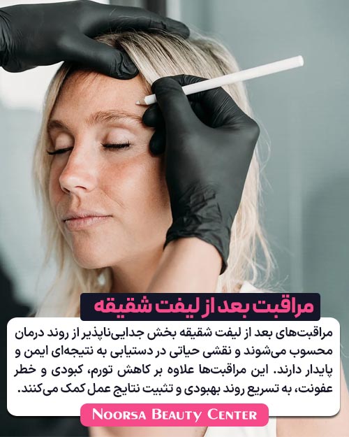 مراقبت بعد از لیفت شقیقه