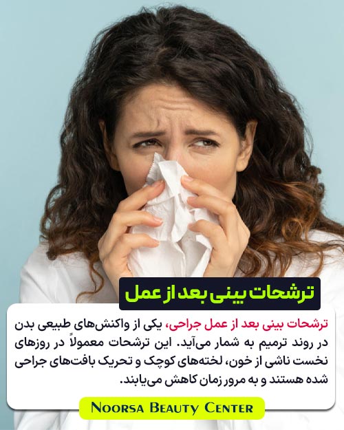 ترشحات بینی بعد از عمل جراحی