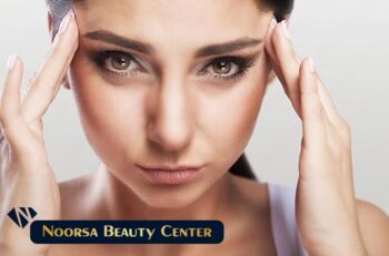 لیفت شقیقه با تکنیک SMAS