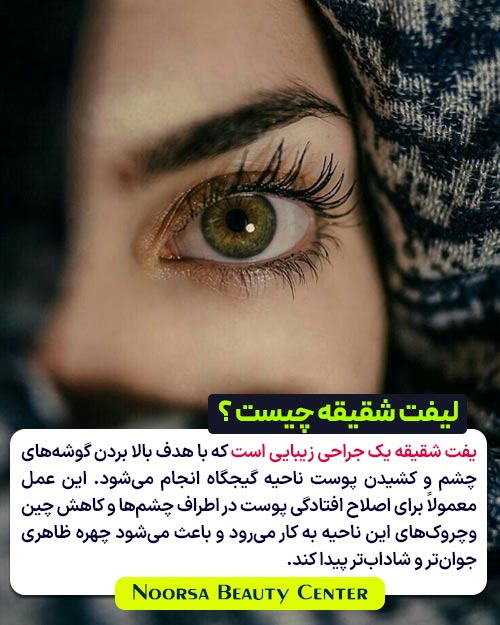 جراحی لیفت شقیقه چیست