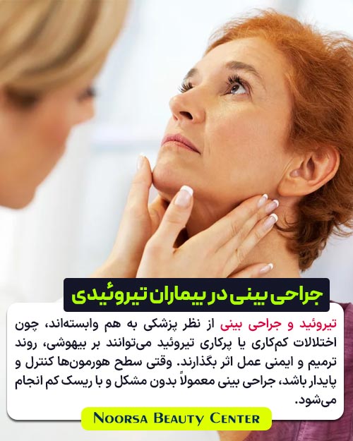 جراحی بینی در بیماران تیروئیدی