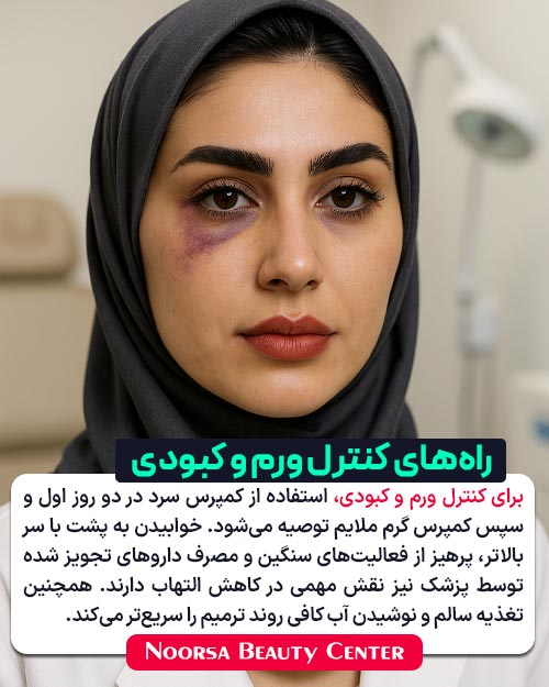 راهکارهای کنترل ورم و کبودی بعد از لیفت شقیقه