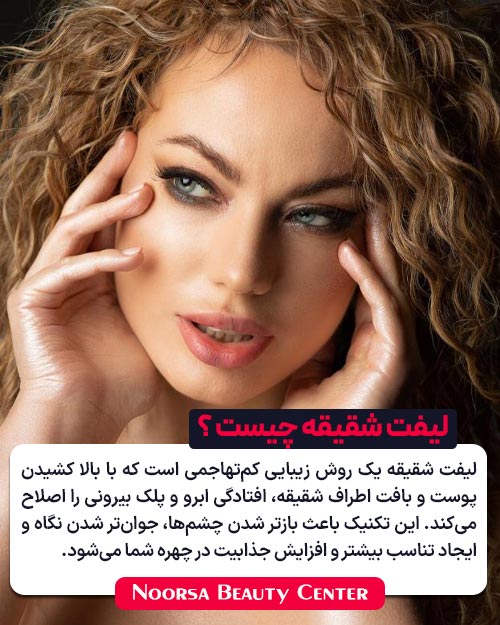 لیفت شقیقه چیست ؟