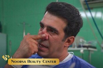 جراحی بینی یوسف تیموری