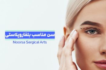 سن مناسب بلفاروپلاستی