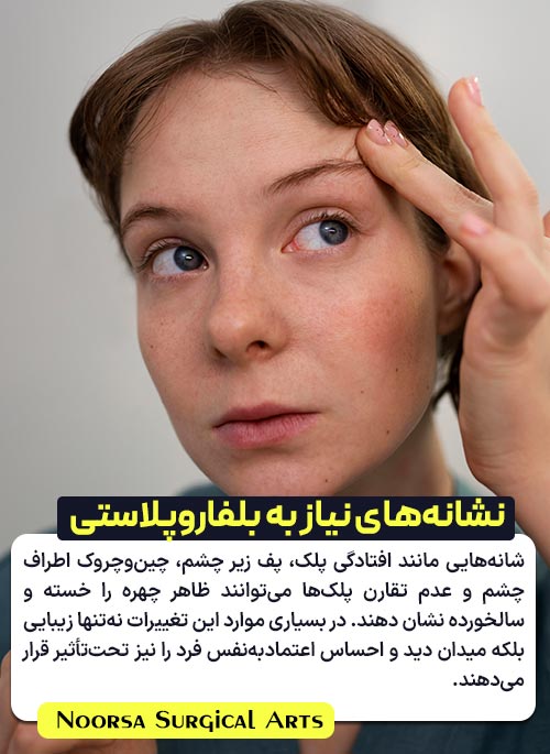 نشانه های نیاز به بلفاروپلاستی