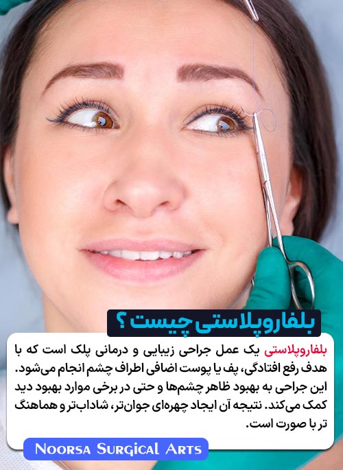 بلفاروپلاستی چیست