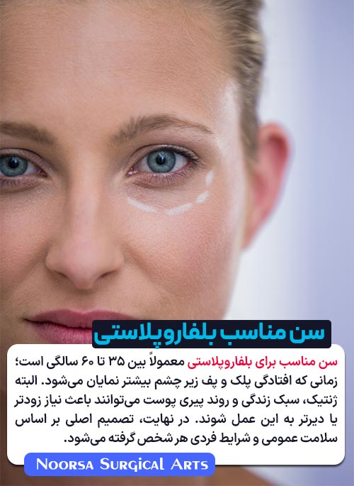 بهترین سن بلفاروپلاستی