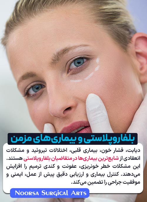 شایع ترین بیماری ها در افراد متقاضی بلفاروپلاستی