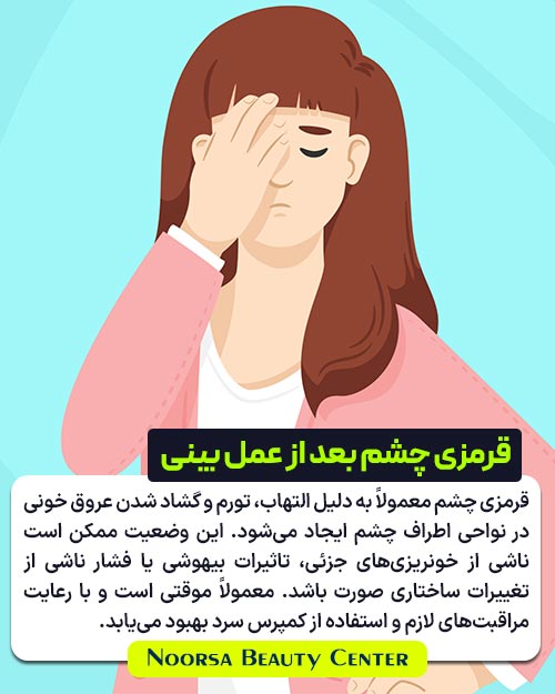 قرمز شدن چشم بعد از عمل بینی