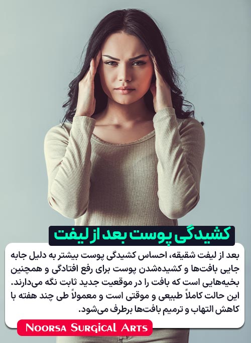 علت احساس کشیدگی پوست بعد از لیفت شقیقه