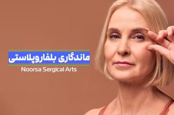 ماندگاری بلفاروپلاستی