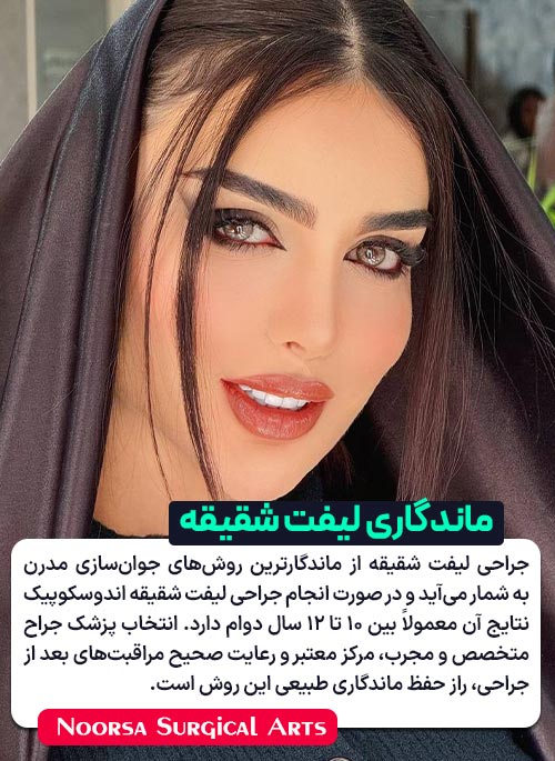 ماندگاری لیفت شقیقه با جراحی