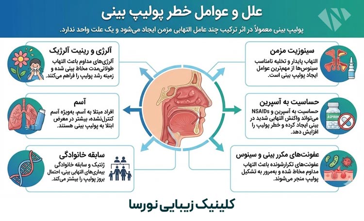علل و عوامل خطر پولیپ بینی