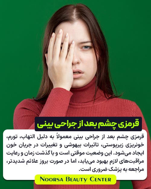 دلایل قرمزی چشم بعد از عمل بینی