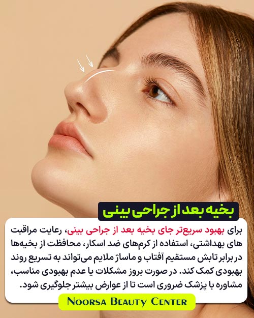بهبود سریع جای بخیه بعد از عمل بینی