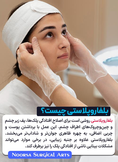 بلفاروپلاستی چیست