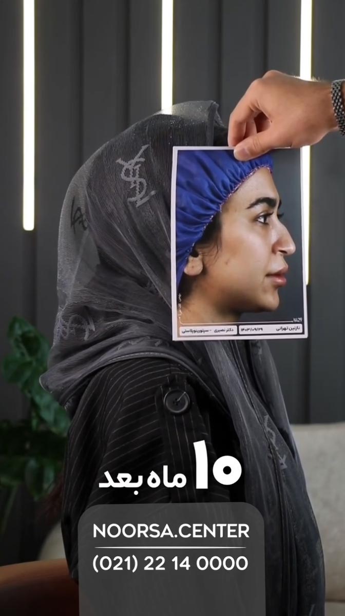 ویدیو نورسا