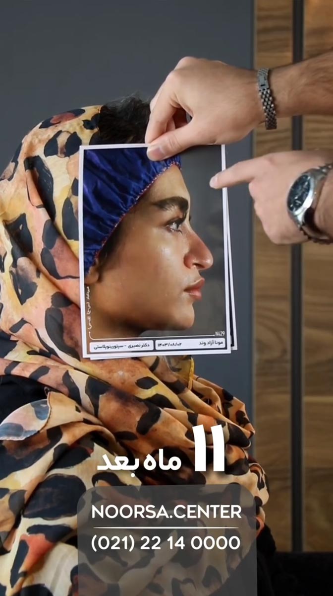 ویدیو نورسا