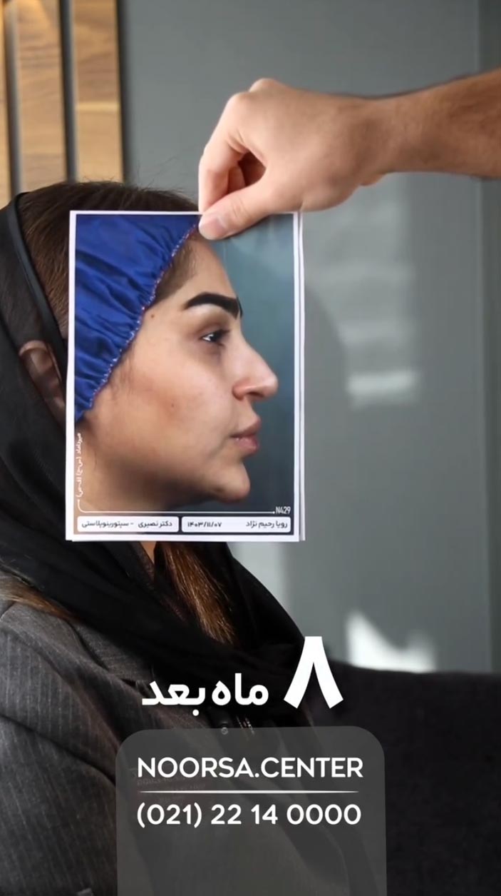 ویدیو نورسا