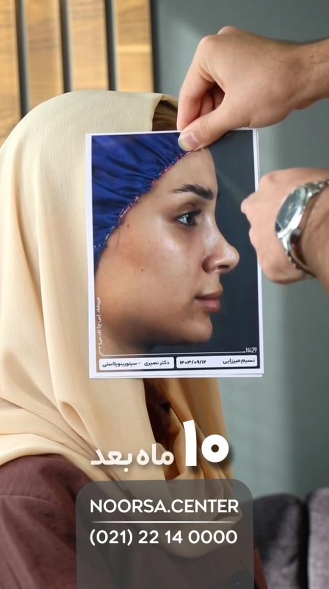 ویدیو نورسا