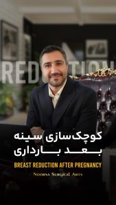 راهکار اصلی کوچک سازی سینه بعد از شیردهی