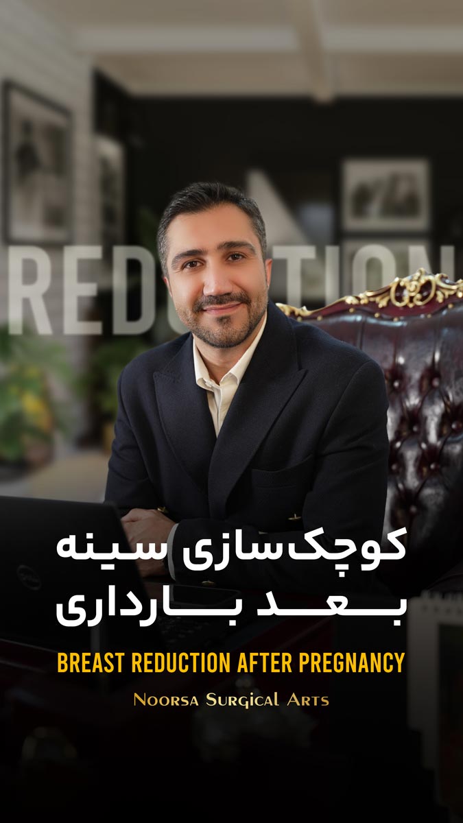 راهکار اصلی کوچک سازی سینه بعد از شیردهی