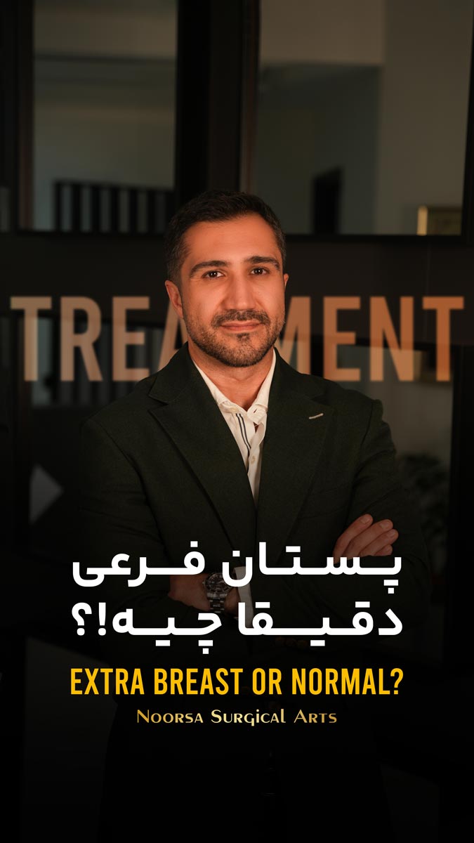 پستان فرعی چیست