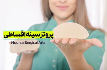 پروتز سینه اقساطی