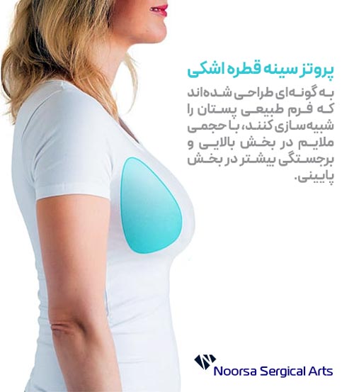 پروتز سینه قطره اشکی
