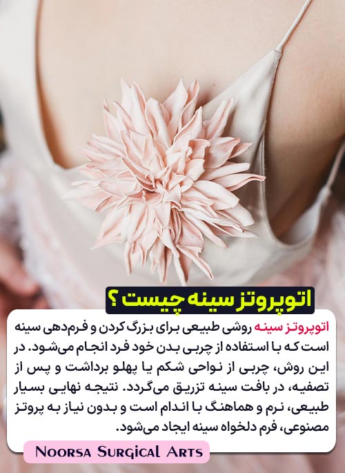 اتوپروتز سینه چیست