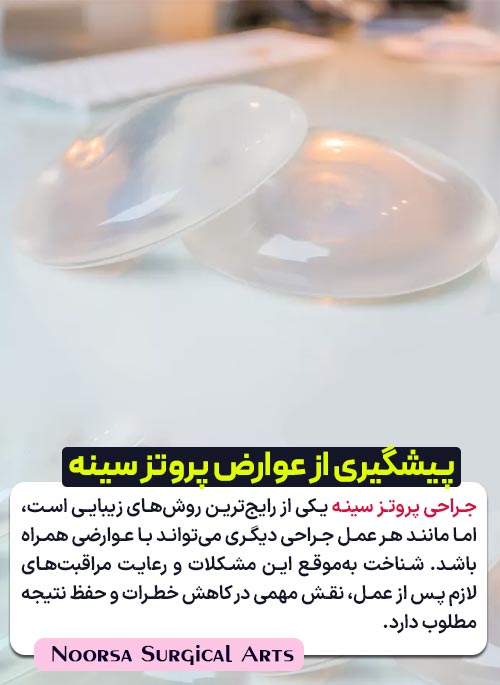 پیشگیری از عوارض پروتز سینه
