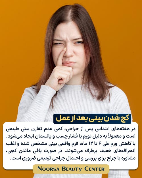کج شدن بینی بعد از عمل جراحی