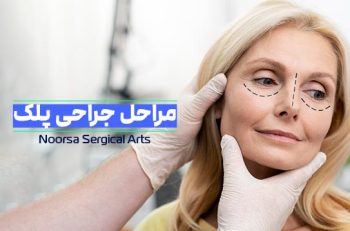 مراحل جراحی بلفاروپلاستی