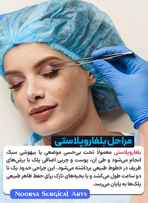 انجام عمل جراحی پلک