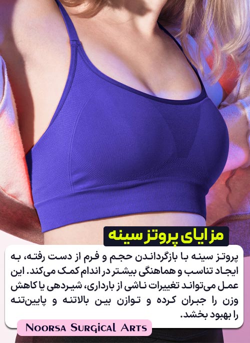مزایای پروتز سینه در بهبود تناسب اندام