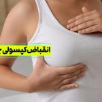 انقباض کپسولی پروتز سینه چیست؟ علائم، پیشگیری و روش‌های درمان