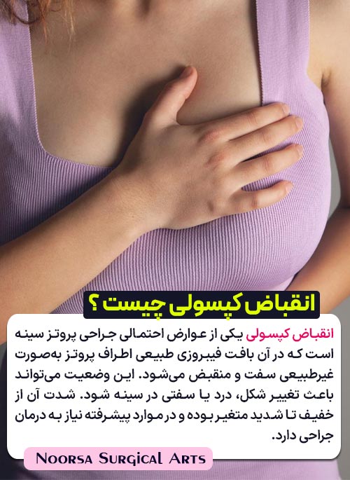 انقباض کپسولی پروتز سینه