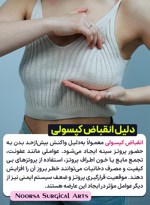 دلایل ایجاد انقباض کپسولی