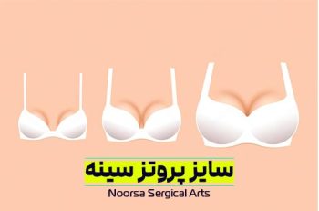 راهنمای انتخاب سایز پروتز سینه