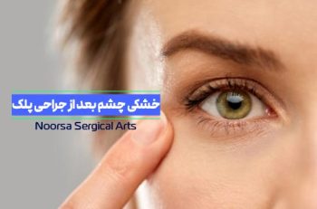 خشکی چشم بعد از بلفاروپلاستی
