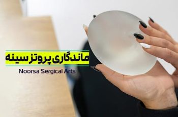 ماندگاری پروتز سینه