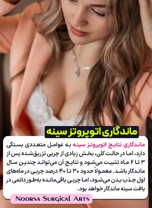 ماندگاری اتوپروتز سینه